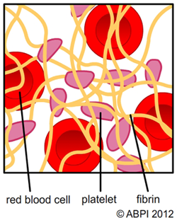 Εικόνα επιλογής